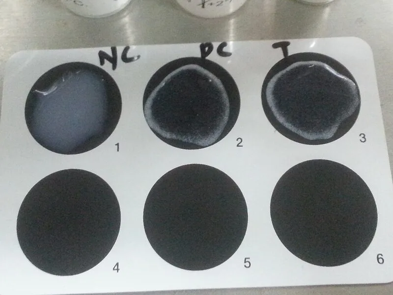 CRP latex agglutination test card with positive result